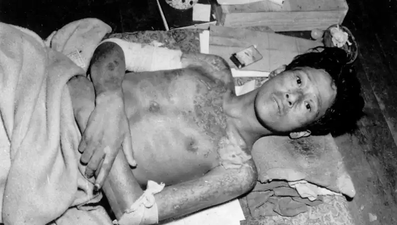80 Yıl Sonra Nagasaki'den Gelen Uyarı: Nükleer Felaket Kapıda
