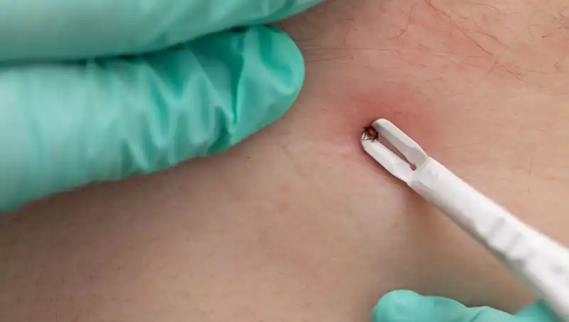 Kene Tehlikesine Karşı Dikkat! Bu Belirtilere Yüzde 100 Dikkat Edin